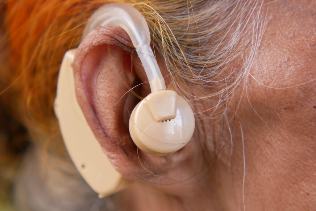 hearing aid concept a senior women with hearing p 2023 11 27 05 23 57 utc scaled
